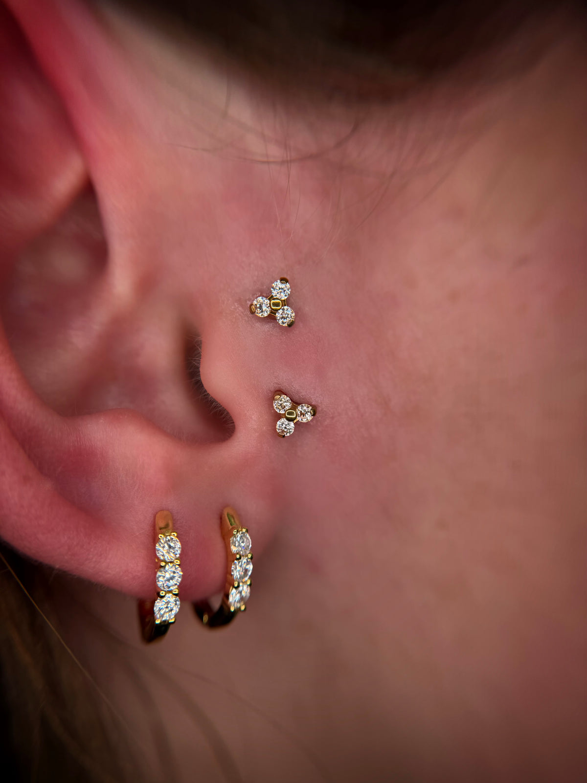 trinite porte surface titane ASTM F136 gold